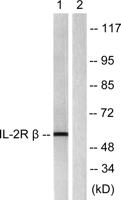 IL-2Rβ Polyclonal Antibody