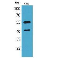 IL-2Rγ Polyclonal Antibody