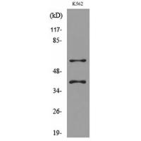 IL-2Rγ Polyclonal Antibody