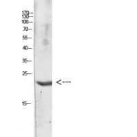 IL-31 Polyclonal Antibody