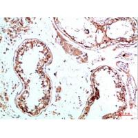 IL-31 Polyclonal Antibody