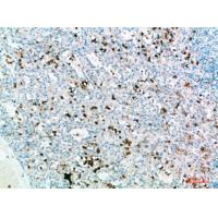 IL-31 Polyclonal Antibody