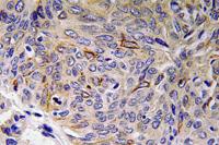 IL-32 Polyclonal Antibody