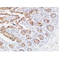 IL-3Rα Polyclonal Antibody