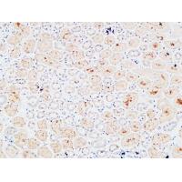 IL-3Rα Polyclonal Antibody