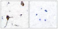 IL-3Rβ Polyclonal Antibody