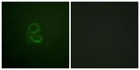 IL-4Rα Polyclonal Antibody
