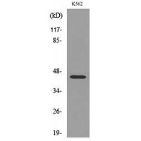 IL-5Rα Polyclonal Antibody