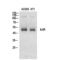 IL-6Rα Polyclonal Antibody