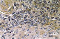 IL-8 Polyclonal Antibody