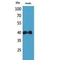 IL-8Rβ Polyclonal Antibody