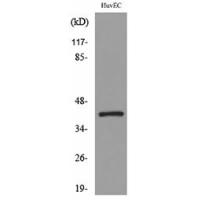 IL-8Rβ Polyclonal Antibody