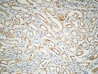 ILK Polyclonal Antibody