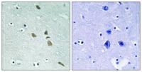 ILK Polyclonal Antibody