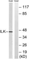 ILK Polyclonal Antibody