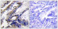 ILKAP Polyclonal Antibody