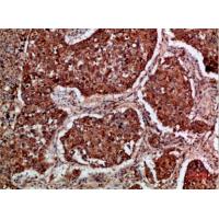 Imp3 Polyclonal Antibody