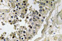 Inhibin β-C Polyclonal Antibody