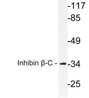 Inhibin β-C Polyclonal Antibody