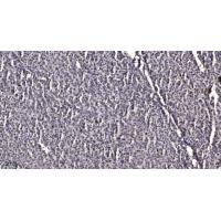 INPP5J Polyclonal Antibody