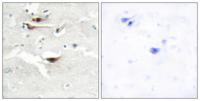 InsP5 2-kinase Polyclonal Antibody