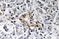 Insulin Polyclonal Antibody
