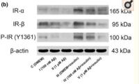 Insulin R Polyclonal Antibody