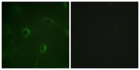 Insulin R Polyclonal Antibody