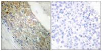 Insulin R Polyclonal Antibody