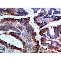 Integrin α1 Polyclonal Antibody
