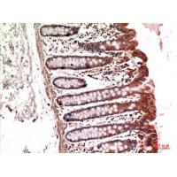 Integrin α5 Polyclonal Antibody
