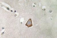 Integrin αV Polyclonal Antibody