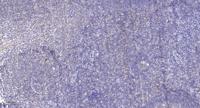 Integrin β1 Polyclonal Antibody