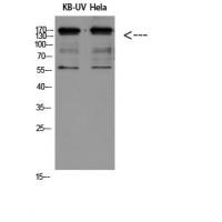 Integrin β2 Polyclonal Antibody