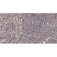 Integrin β2 Polyclonal Antibody