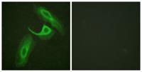 Integrin β2 Polyclonal Antibody