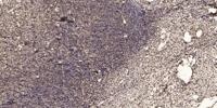 Integrin β2 Polyclonal Antibody