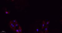 Integrin β3 Polyclonal Antibody