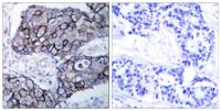 Integrin β3 Polyclonal Antibody