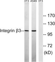Integrin β3 Polyclonal Antibody