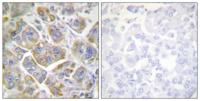 Integrin β4 Polyclonal Antibody