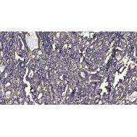 Internexin-α Polyclonal Antibody