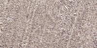 Intestinal Cell Kinase Polyclonal Antibody