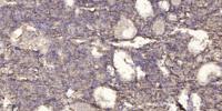 INTS2 Polyclonal Antibody