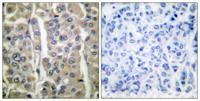 Involucrin Polyclonal Antibody