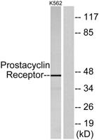 IP Receptor Polyclonal Antibody