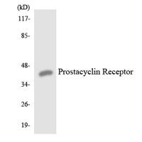 IP Receptor Polyclonal Antibody