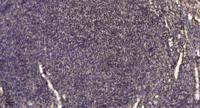 IP Receptor Polyclonal Antibody