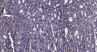 IP3KA Polyclonal Antibody