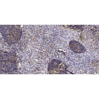 IP3R-I Polyclonal Antibody